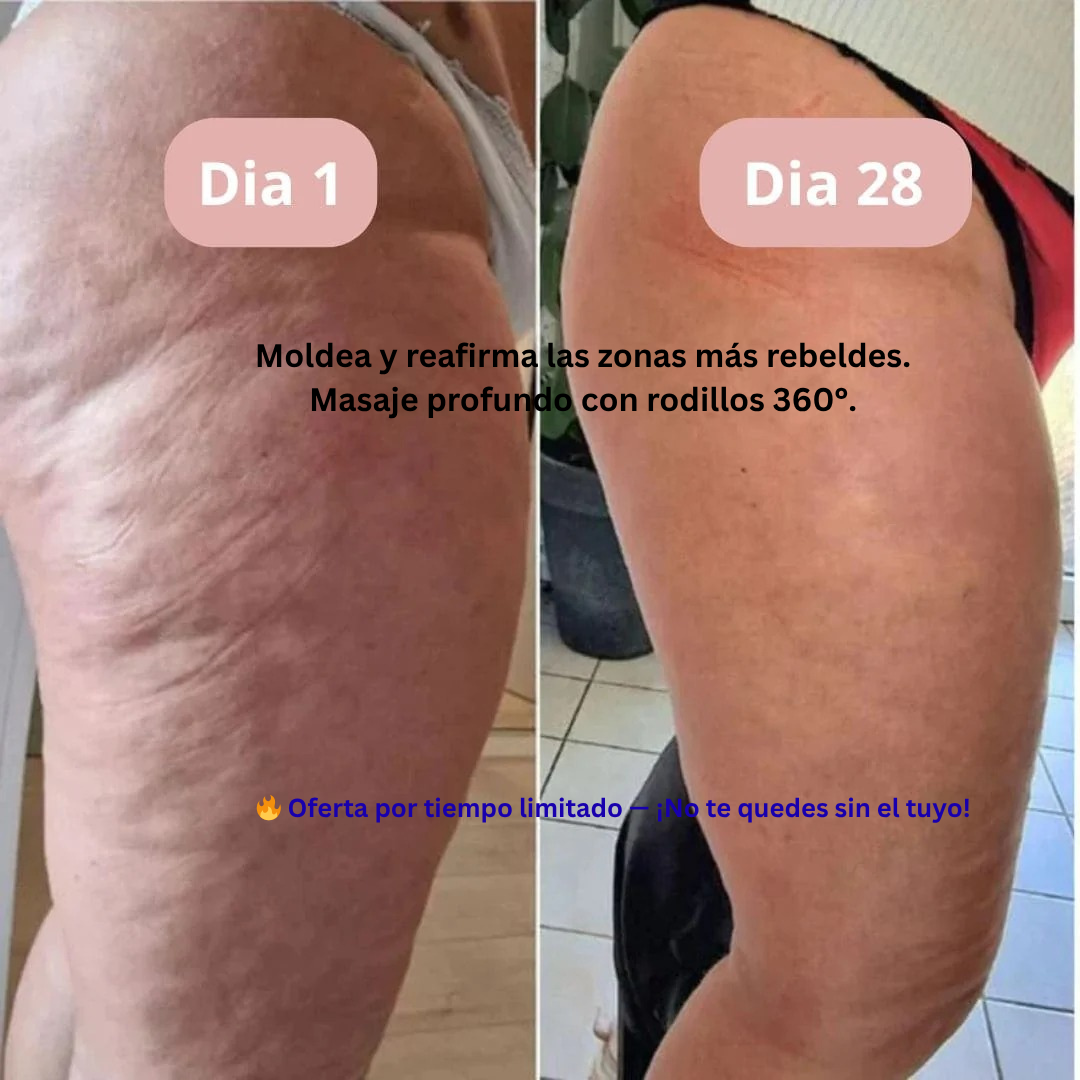 Rodillo masajeador 360° Anticelulitis