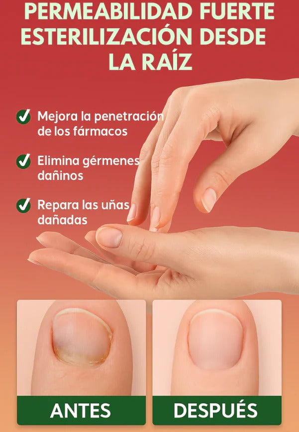 RELIEF OIL Anti Hongos. Con ingredientes naturales.